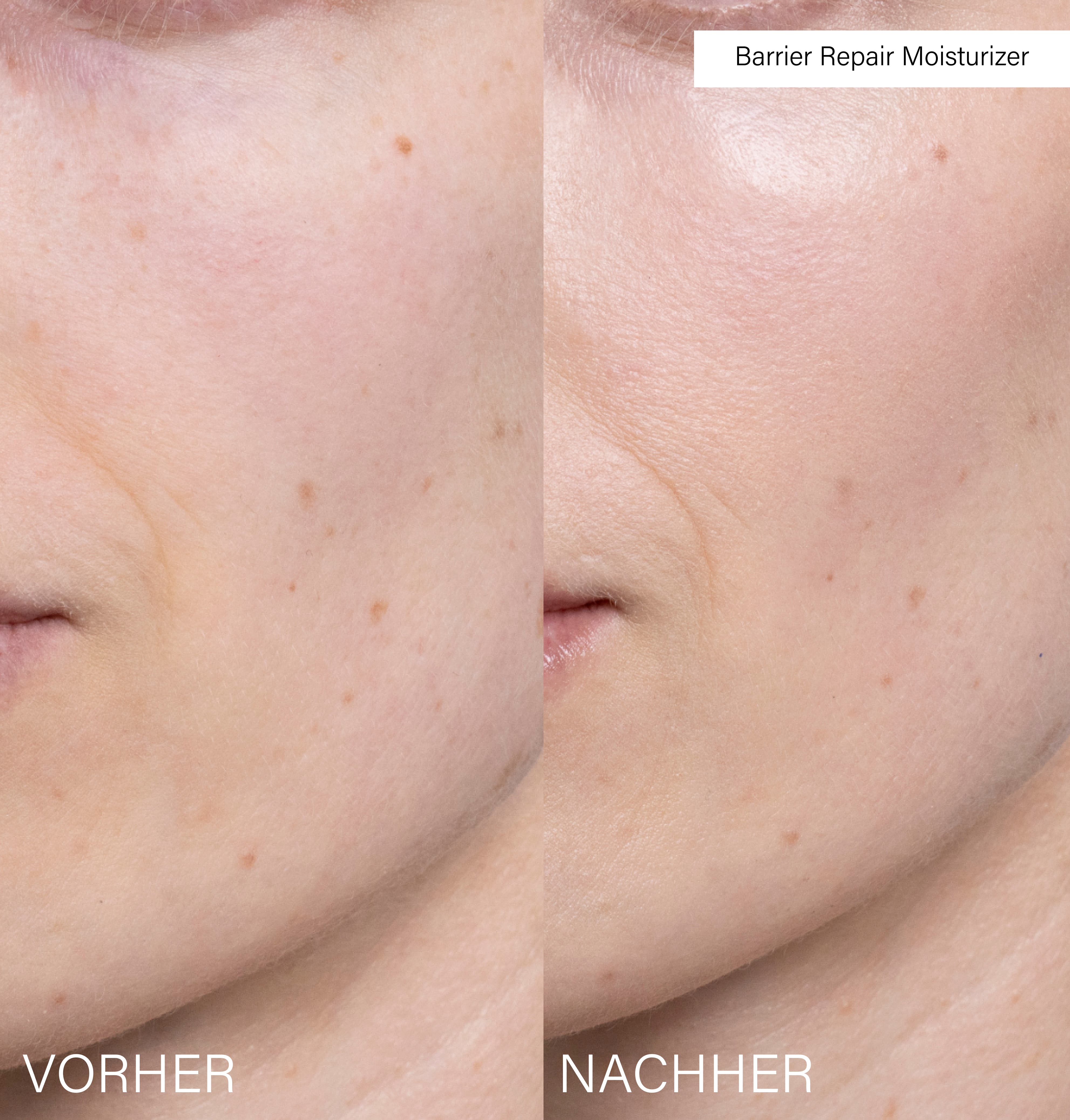 Hydrating Repair Set