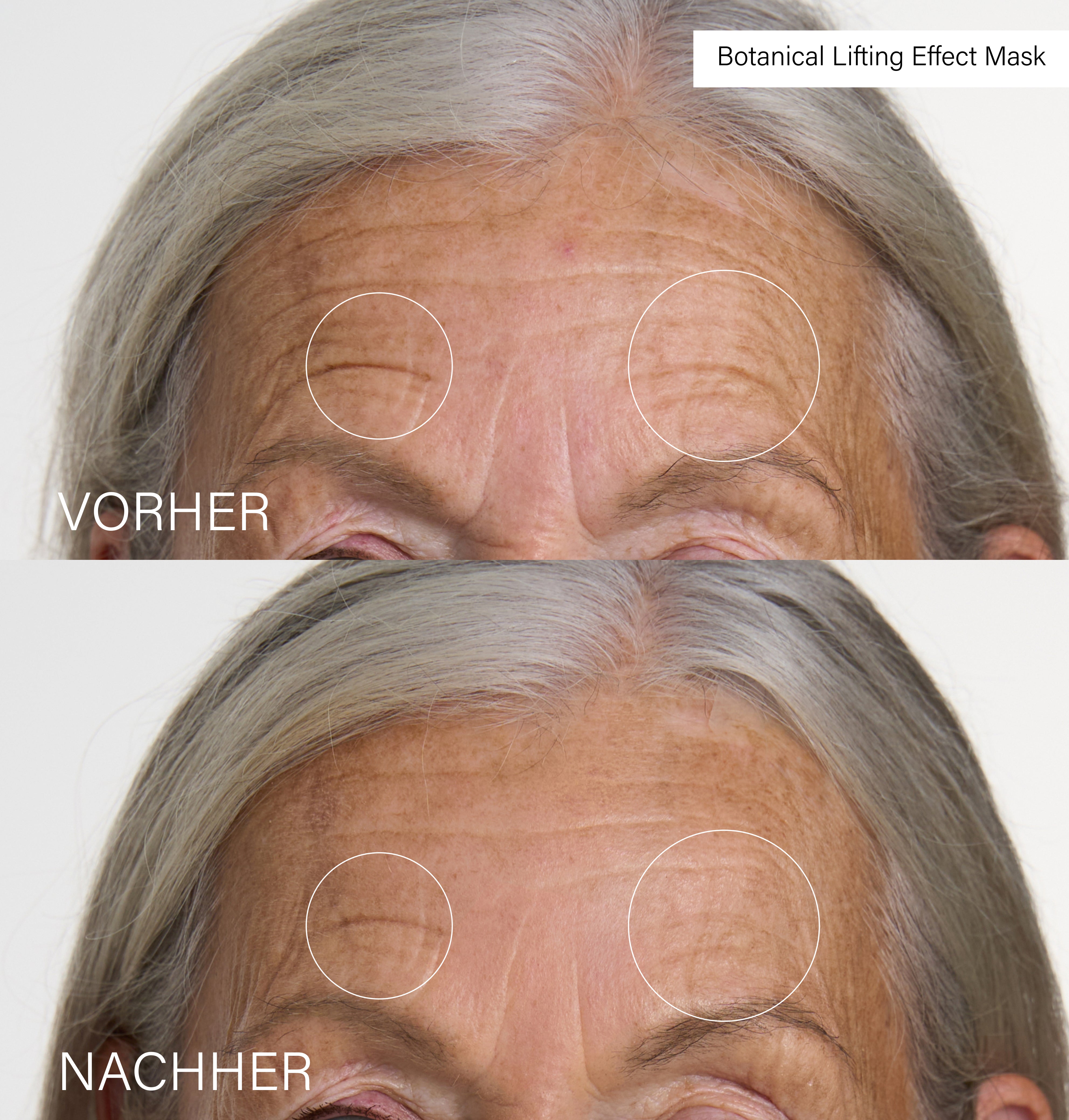 Botanical Filler Duo