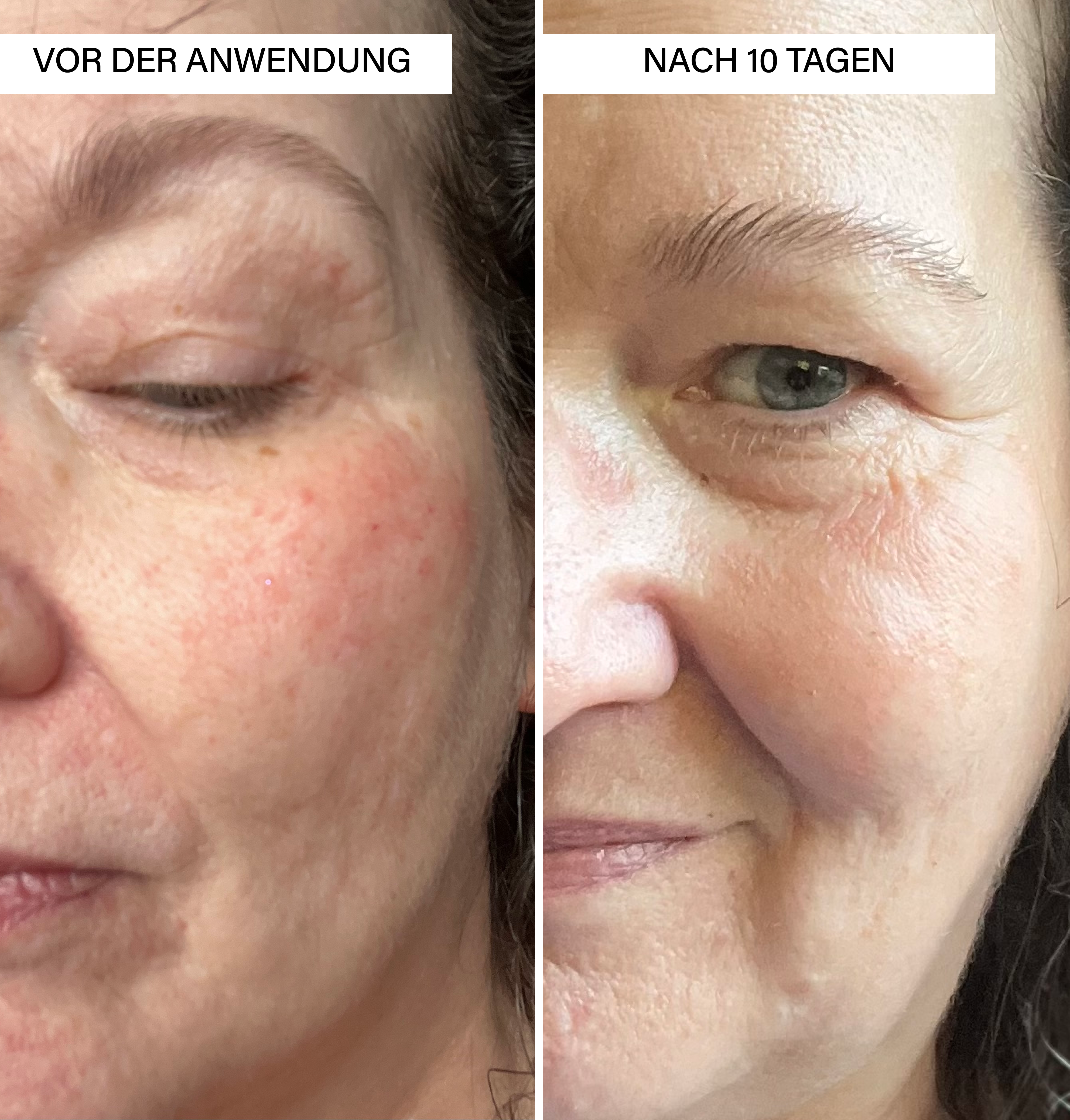 Brightening Serum | with Vitamin C & Botanics