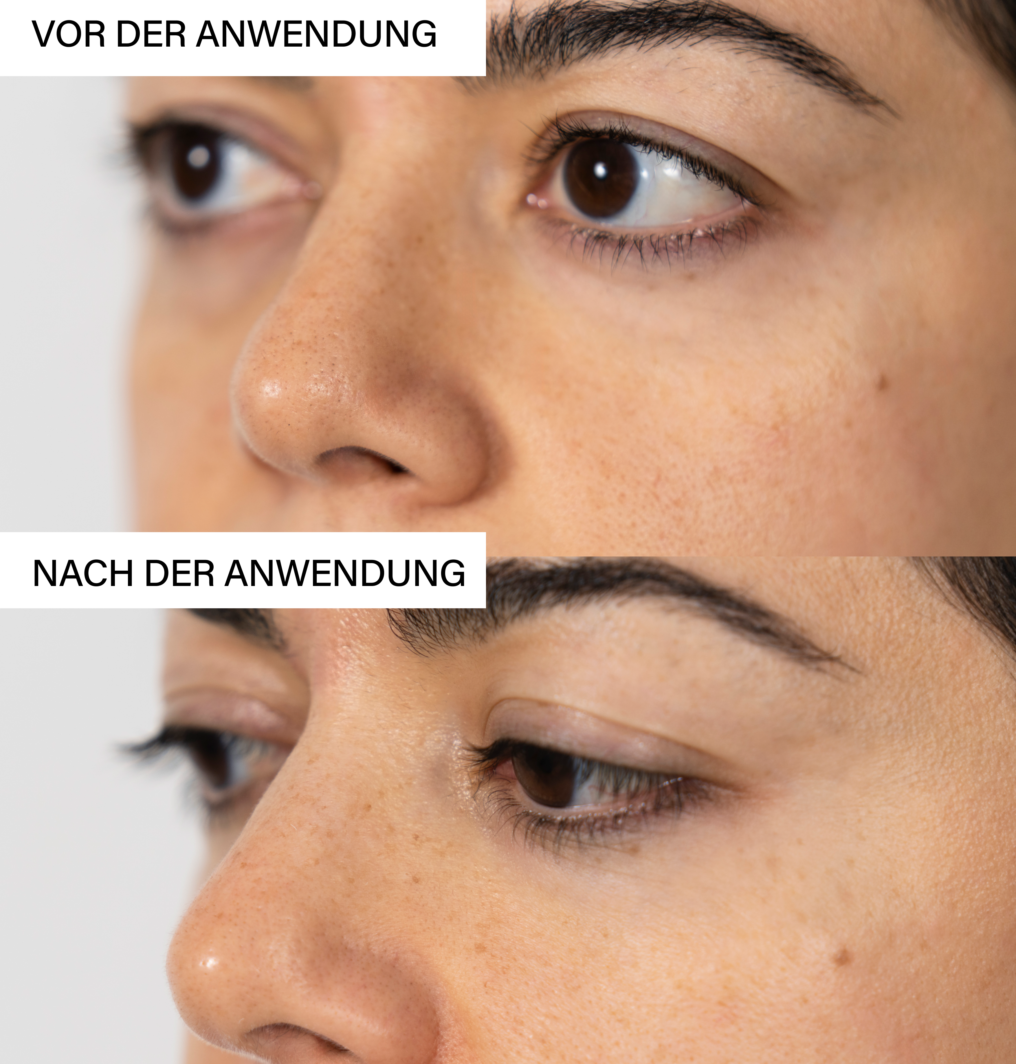 Anti-Breakout Exfoliating Set