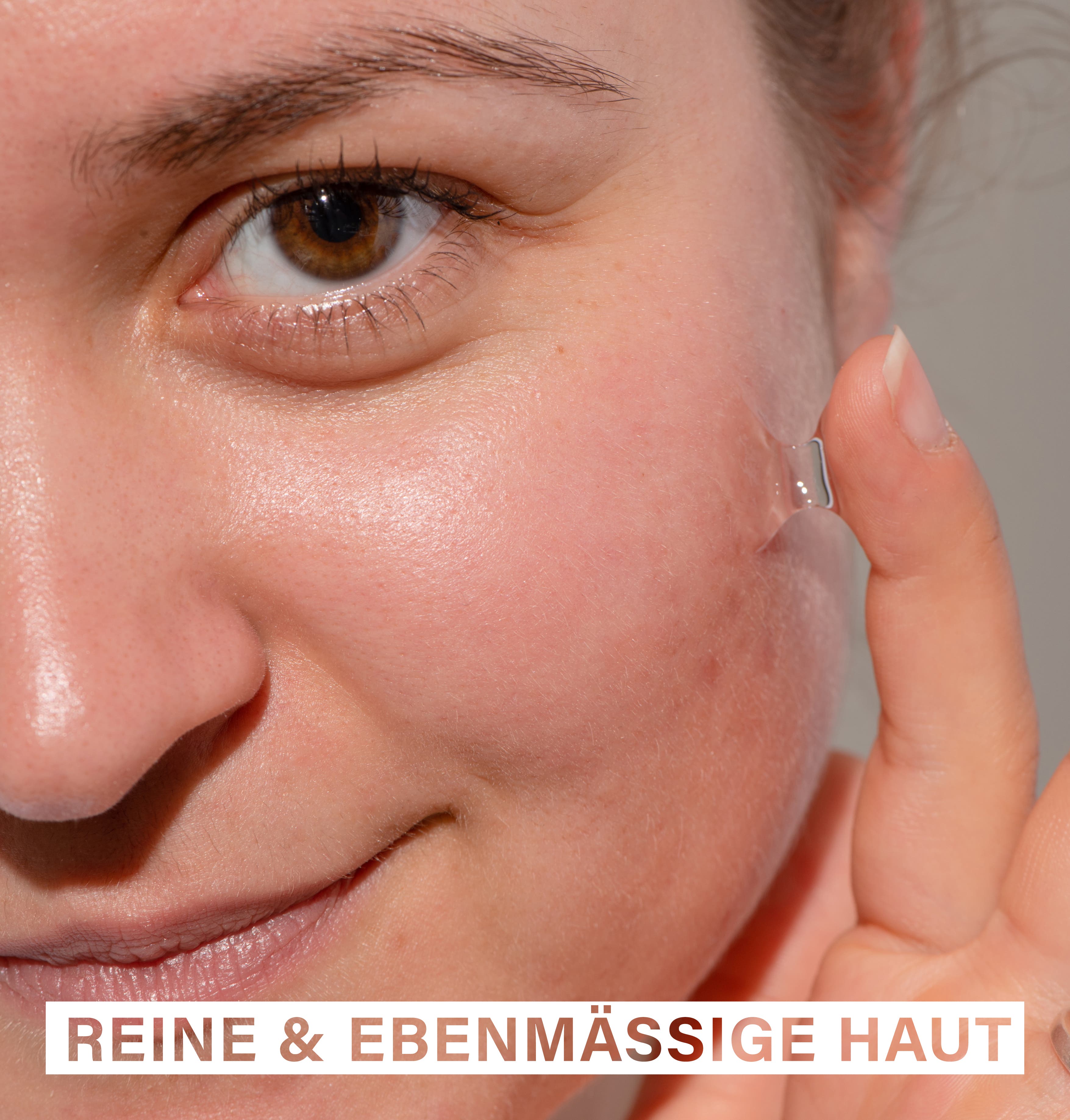 Anti Breakout Serum | with Zinc, Tea Tree Oil & Probiotics