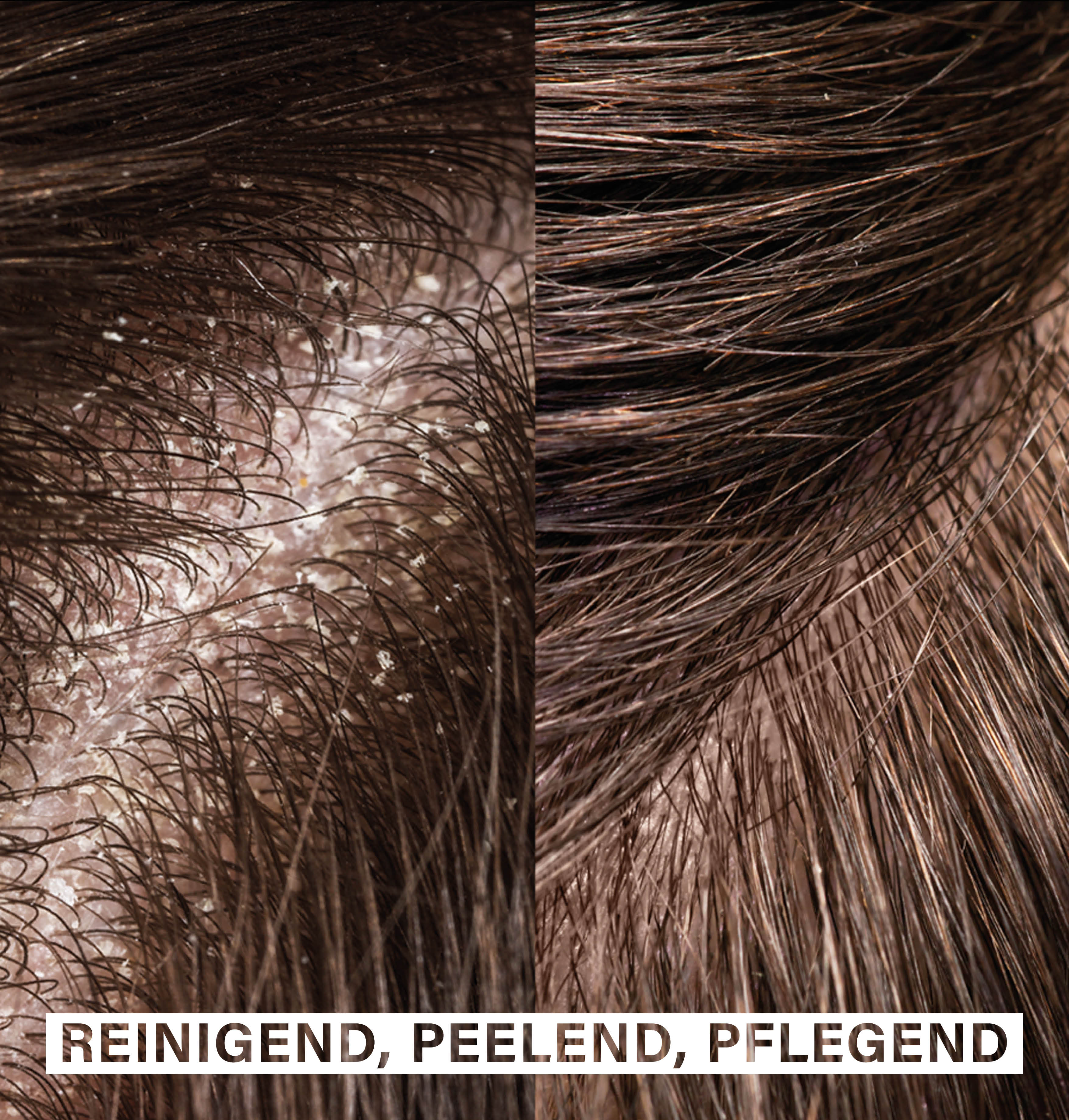 Scalp Exfoliating Shampoo | with papaya extract