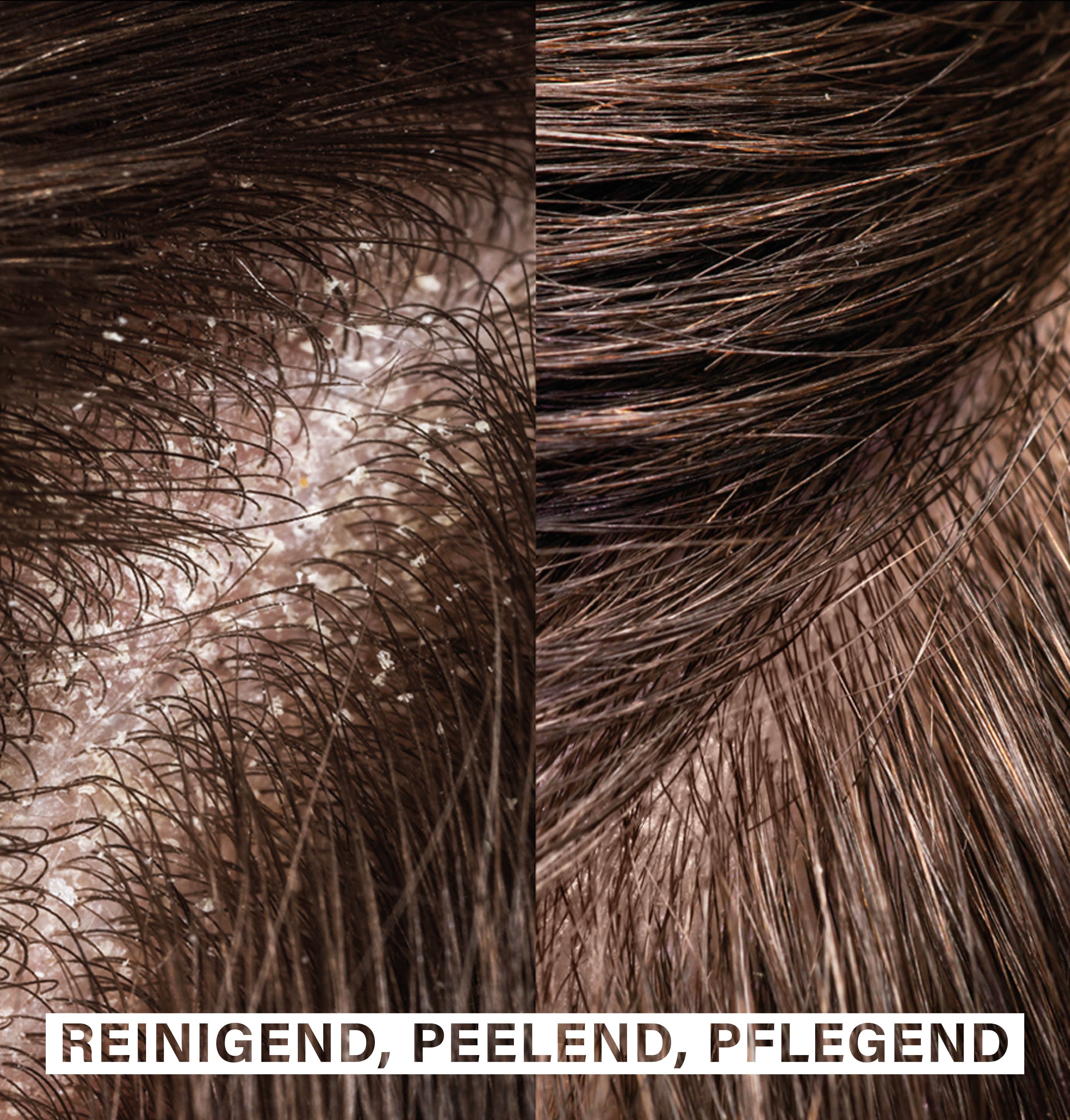 Exfoliating Hair Brush