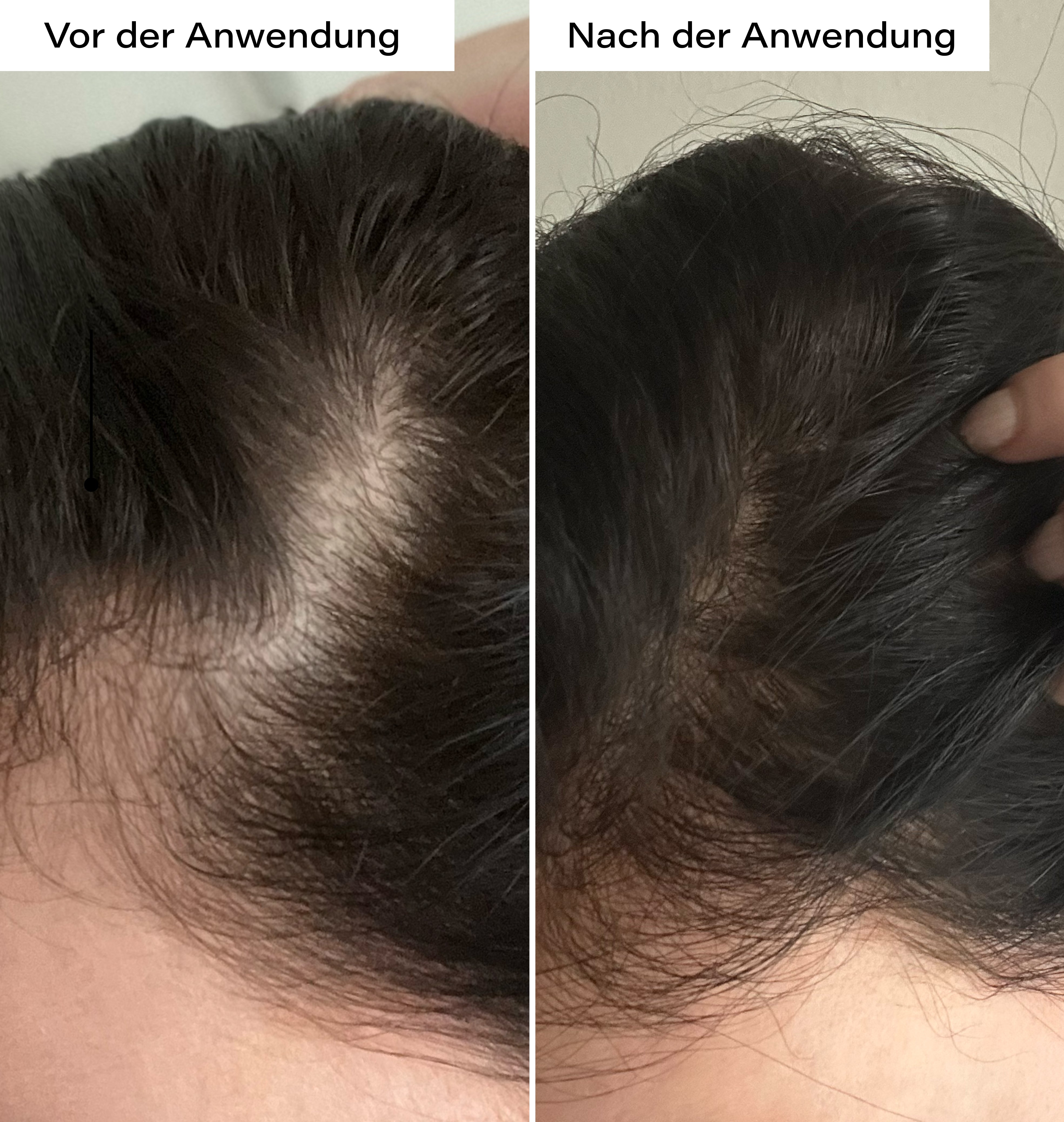 Hair Growth Boost Duo