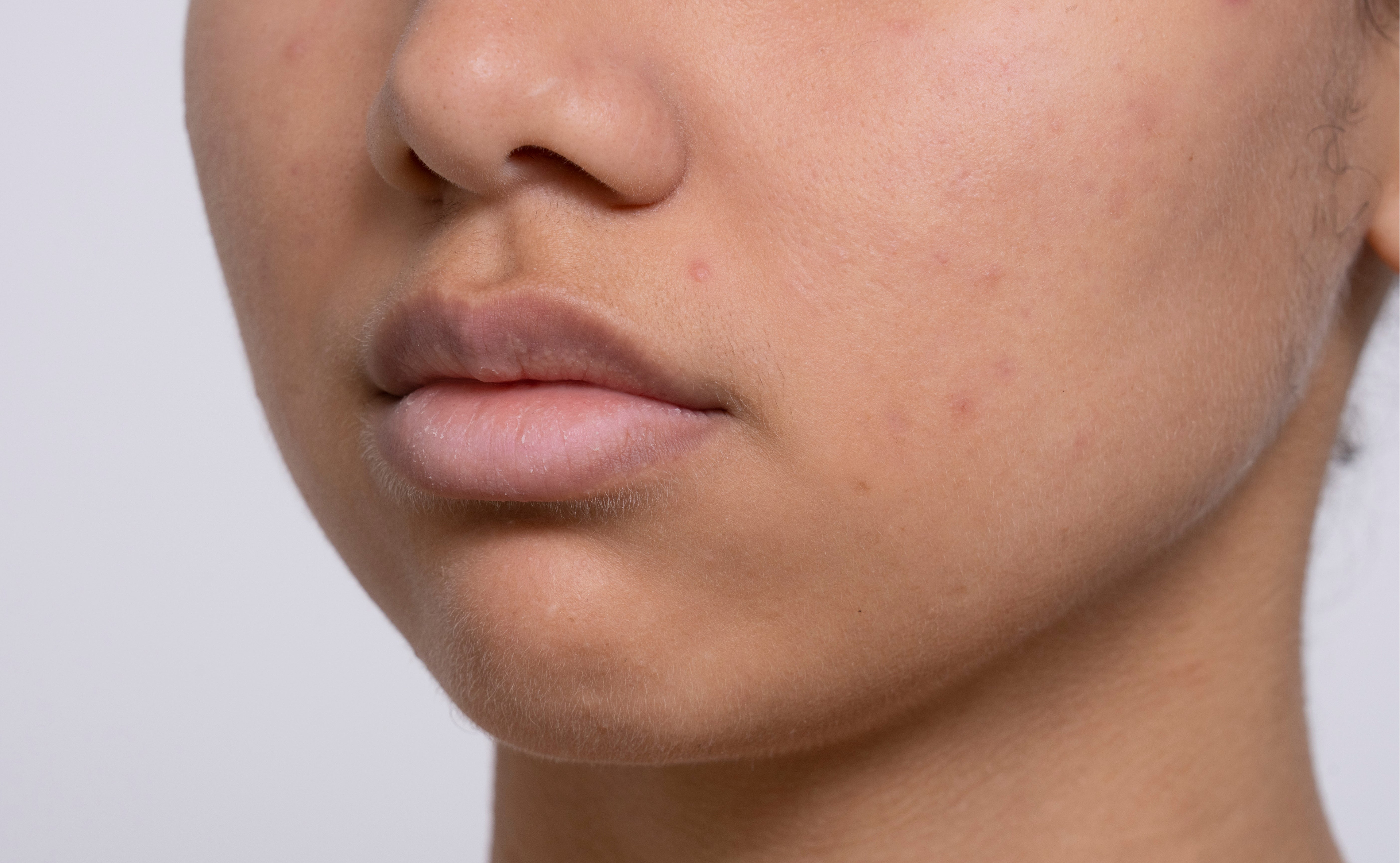 Untere Gesichtshälfte einer Frau mit Fokus auf Wange, Poren und Mundwinkel.