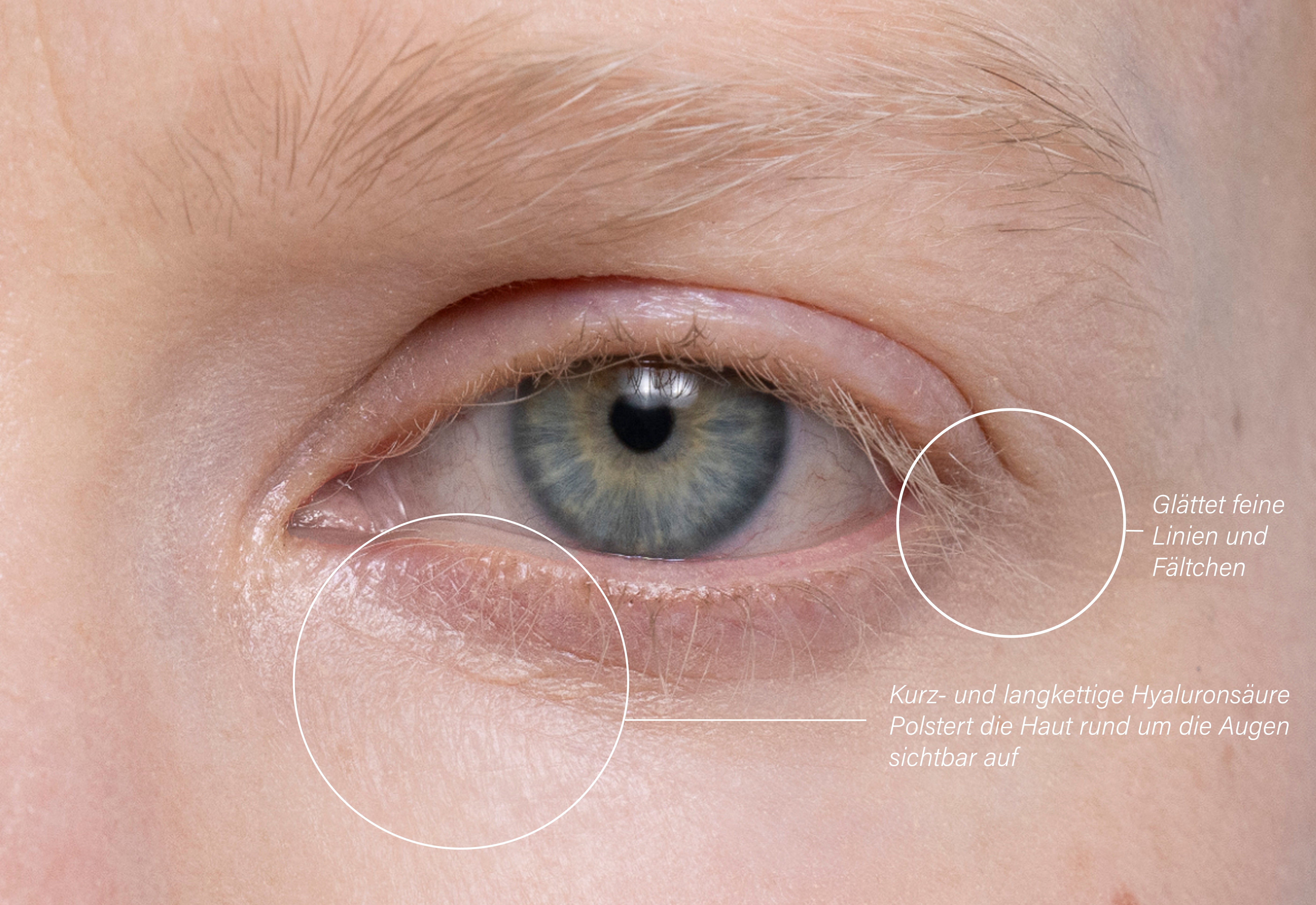 Nahaufnahme eines blauen Auges mit feinen hellen Wimpern und markierten Fältchen.