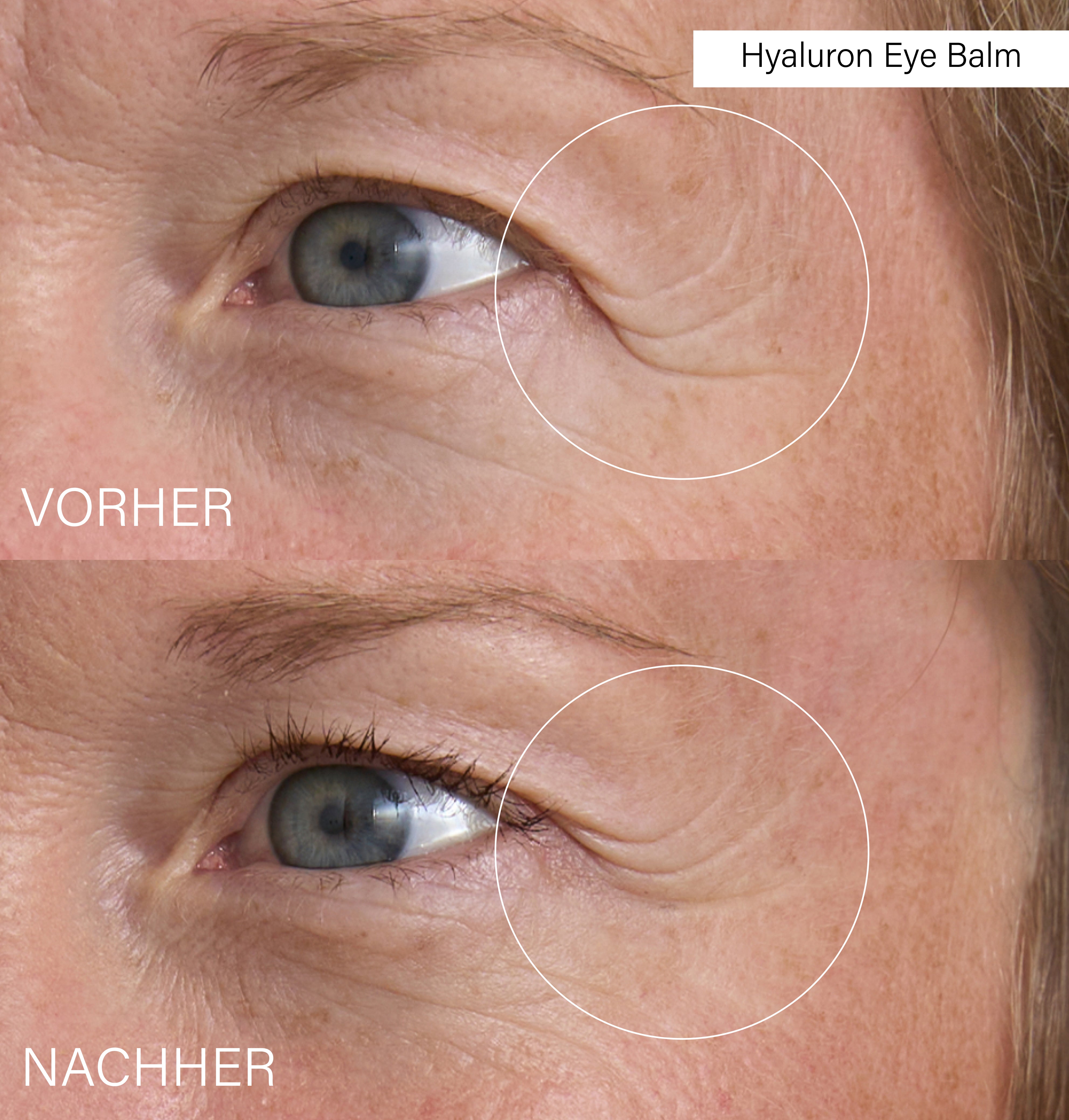 Day &amp; Night Eye Balm Set