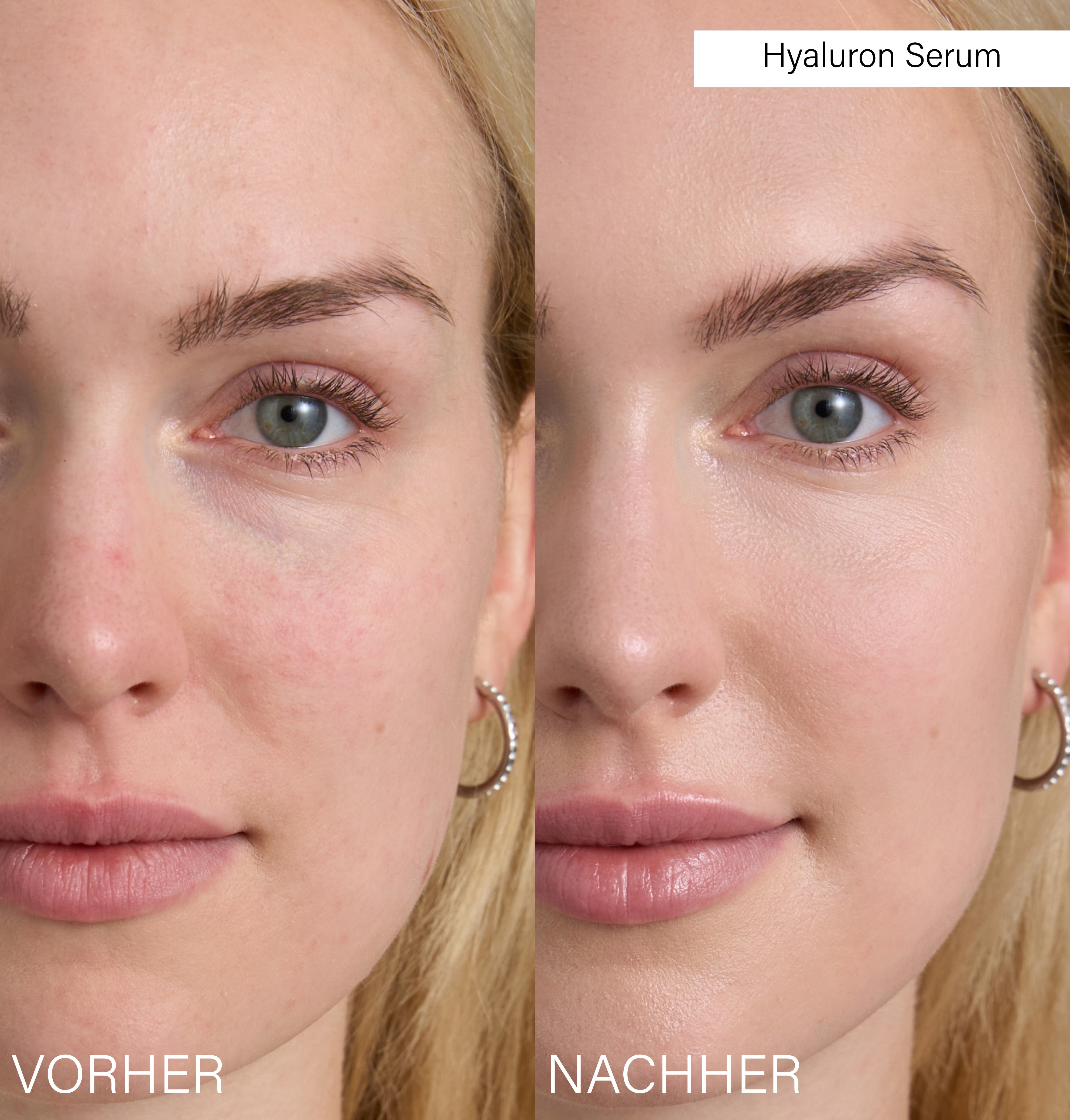 Beauty Bag + Bestseller Serum Set