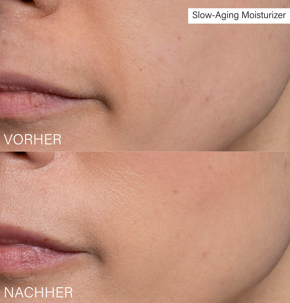 Slow Aging Moisturizer | with Rosehip and Hyaluron